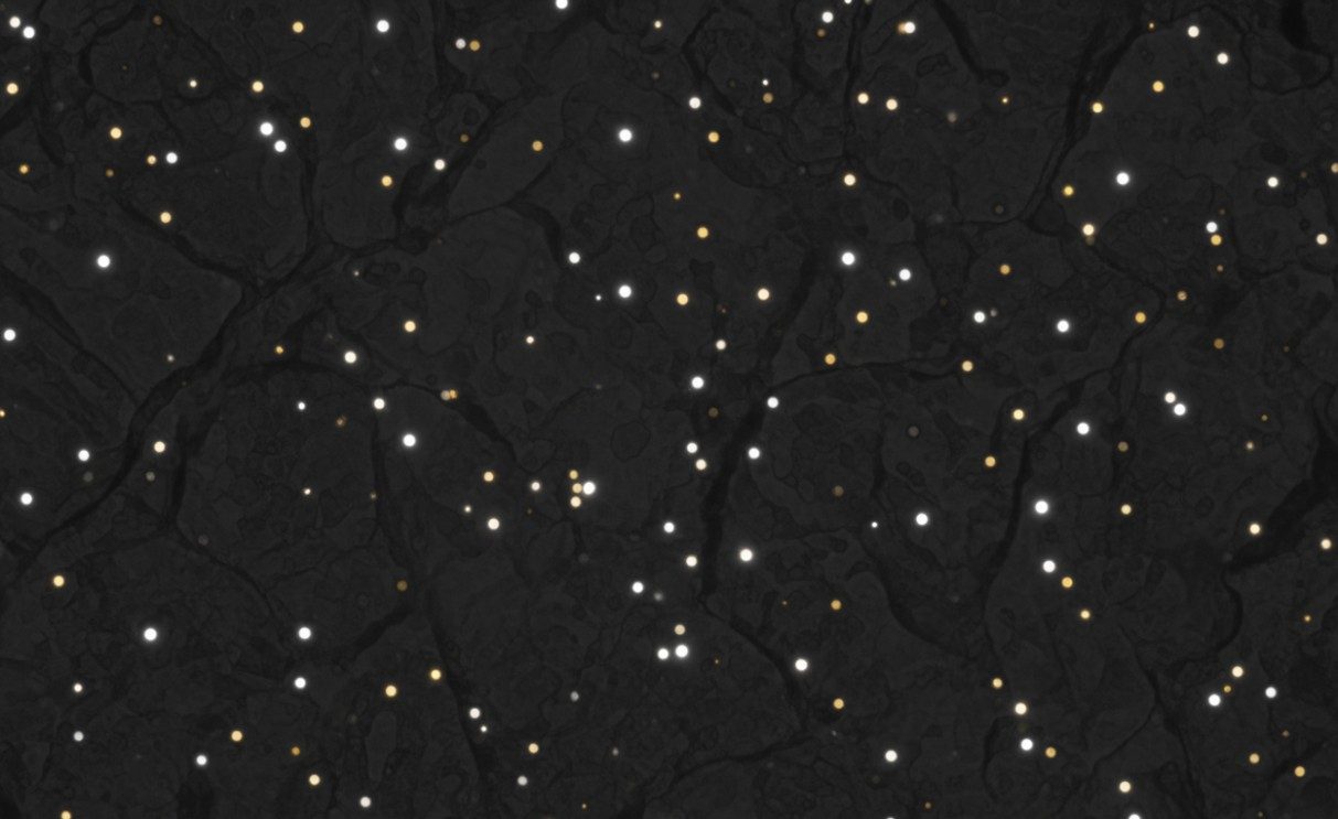 HAADF-STEM view of dispersed single atoms on carbon support.