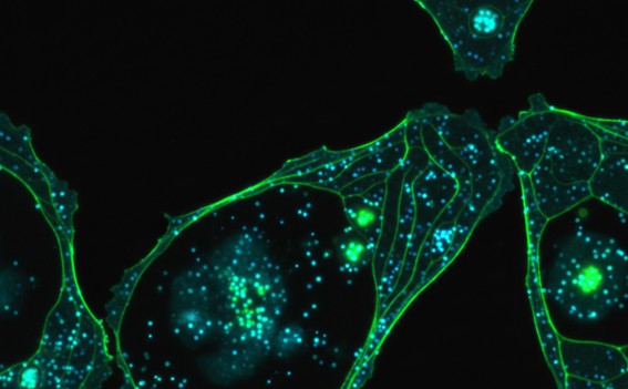 Fluorescence micrograph of AIE nanoparticles inside live cells.