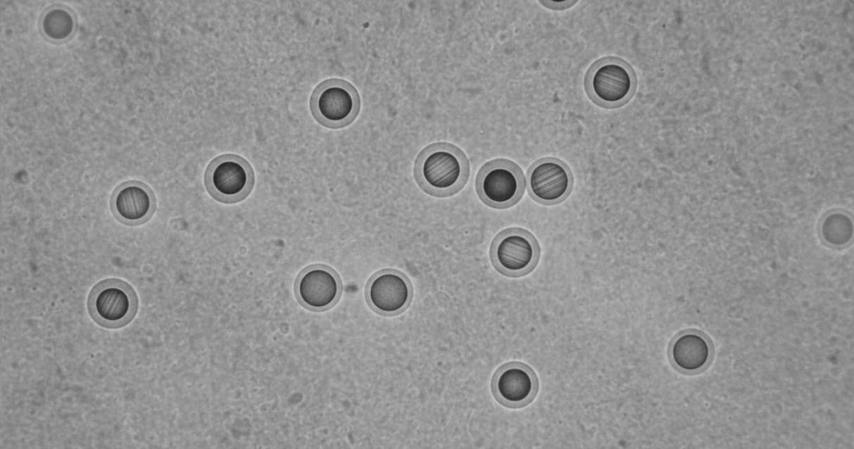 TEM image of Pt-Co core-shell nanoparticles showing distinct core-shell contrast dispersed on carbon support for electrocatalysis